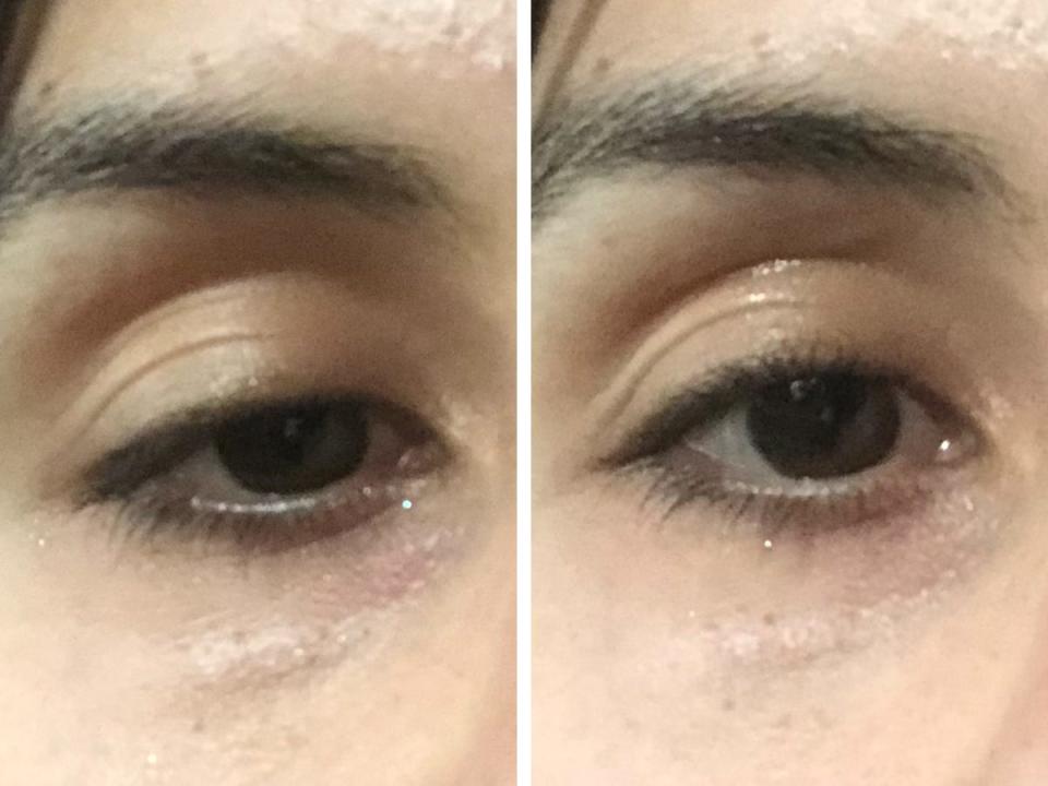 Solawave eyes before and after