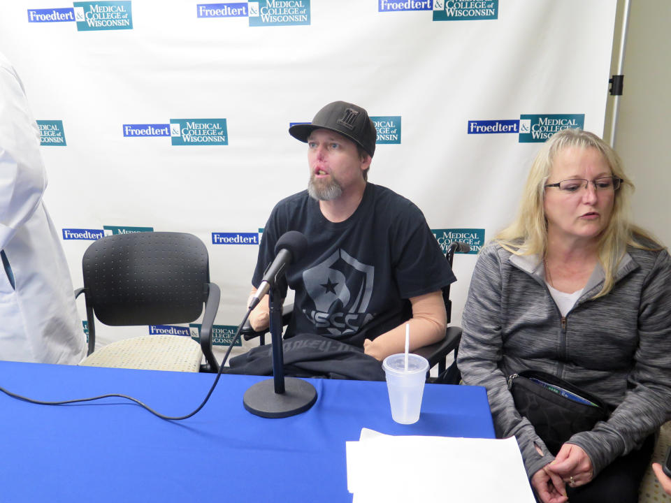 Greg Manteufel, left, and his wife Dawn Manteufel, speak to reporters on Tuesday, Oct.2, 2018, in Milwaukee, about his recovery from a rare blood infection that led to the amputation of part of his forearms and legs. Doctors say the blood infection was caused by dog saliva. (AP Photo/Ivan Moreno)