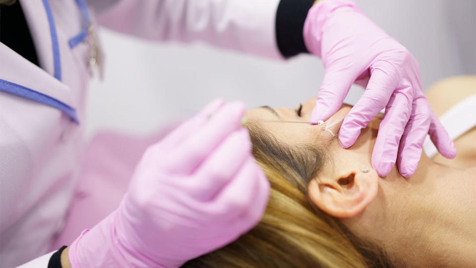 woman getting a thread lift by a doctor