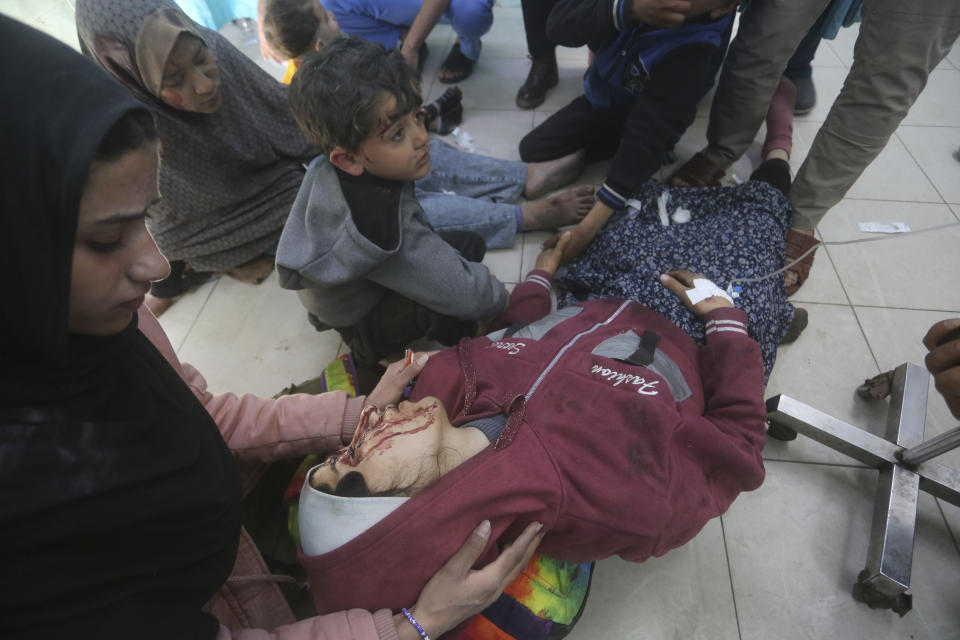 A Palestinian girl wounded in the Israeli bombardment of the Gaza Strip is treated at a hospital in Rafah on Tuesday, Jan. 16, 2024. (AP Photo/Hatem Ali)