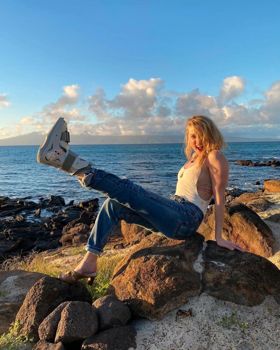 Amber Heard poses by the ocean with a foot boot cast