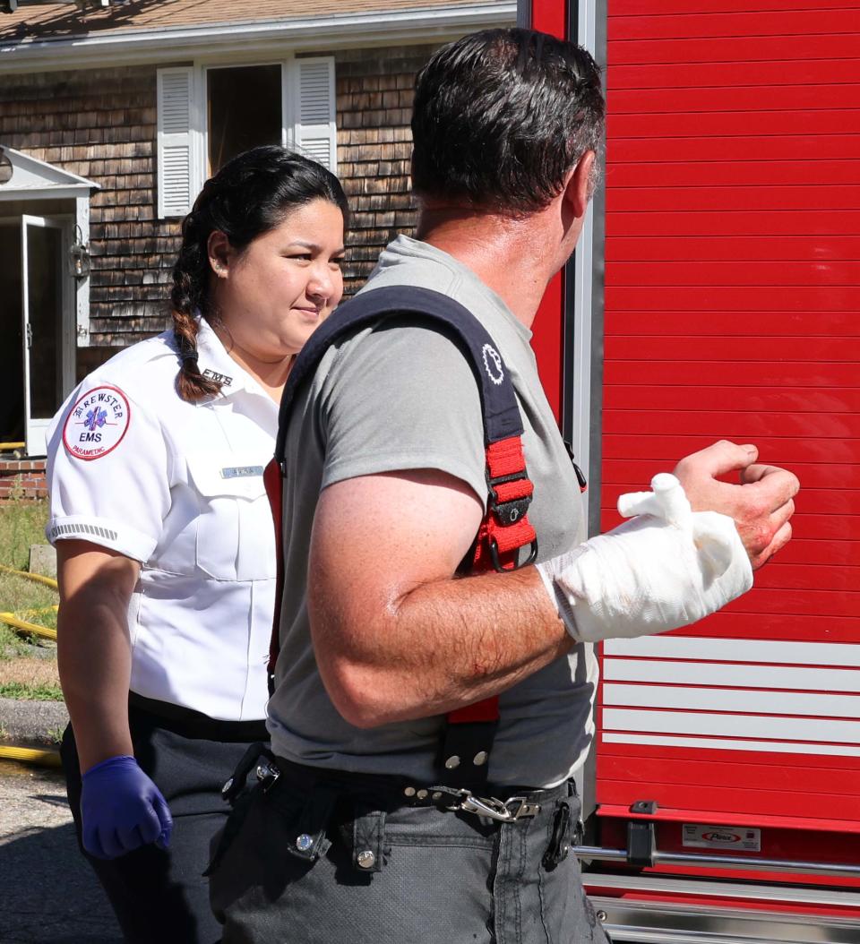 Brockton Fire Lt. Christopher Gallant injured his right hand while battling a house fire at 135 Maplewood Circle on Sunday, August 14, 2022.