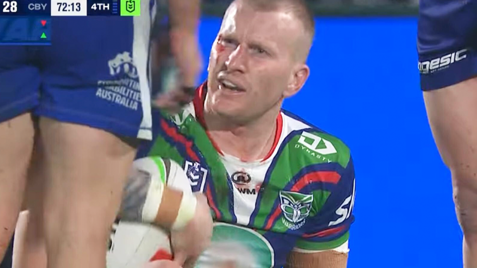 Mitch Barnett (pictured) was left bloodied and bruised after a high-shot from Max King. (Image: NRL.com.au)