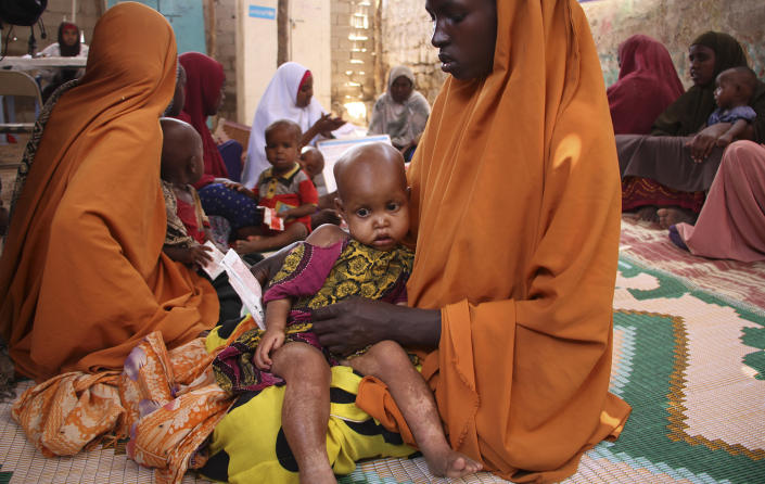 <p>In this photo taken Saturday, March 25, 2017, a Somali woman holds her child Dahabo Sheikh Mumin, 1, as they attend a health center in Baidoa, Somalia. Somalia’s drought is threatening 3 million lives according to the U.N. and in recent months aid agencies have been scaling up their efforts but say more support is urgently needed to prevent the crisis from worsening. (Farah Abdi Warsameh/AP) </p>