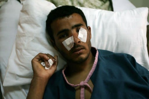 A Yemeni tribesman loyal to tribal chief Sadiq al-Ahmar lies on a hospital bed in Sanaa after sustaining wounds in fighting. Security forces in the Yemeni capital battled heavily armed supporters of the country's most powerful tribal leader on Thursday as President Ali Abdullah Saleh ordered the tribesman's arrest