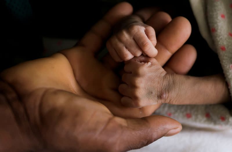 Woldegebrial Abadi, 36, holds the hands of his severely malnourished newborn son Berhanu Woldegebrial at the Samre Hospital, in Tigray Region