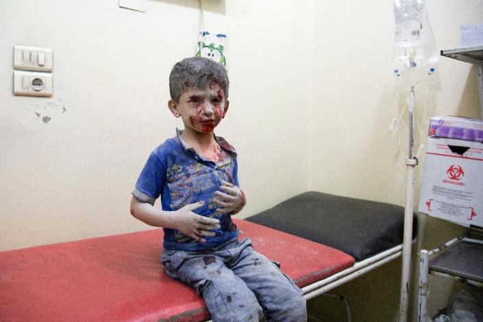 A Syrian boy awaits treatment at a make-shift hospital following air strikes on rebel-held eastern areas of Aleppo on September 24, 2016 (AFP Photo/Karam Al-Masri)