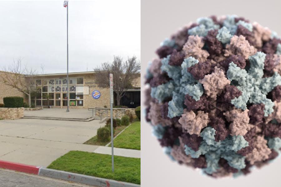 Cierran escuela en California debido a brote masivo de norovirus