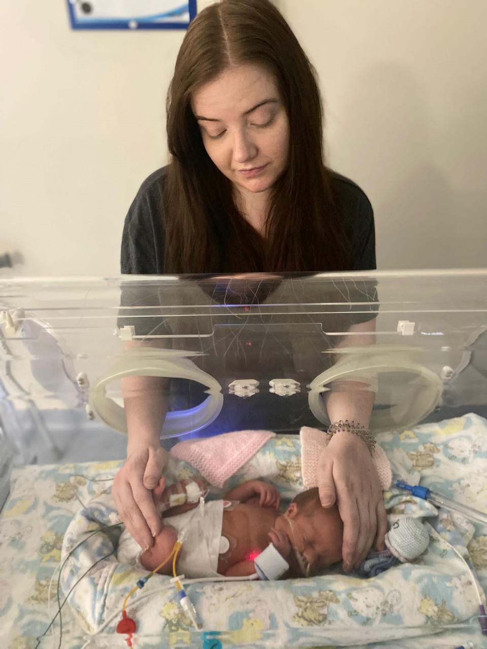 Premature baby Sienna had to be cared for in an incubator. (SWNS)