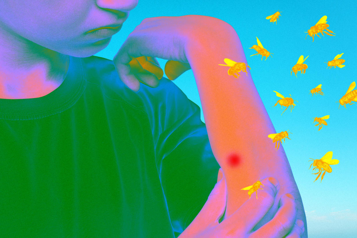 A photo illustration shows a red spot on a child's arm and a swarm of bugs nearby.