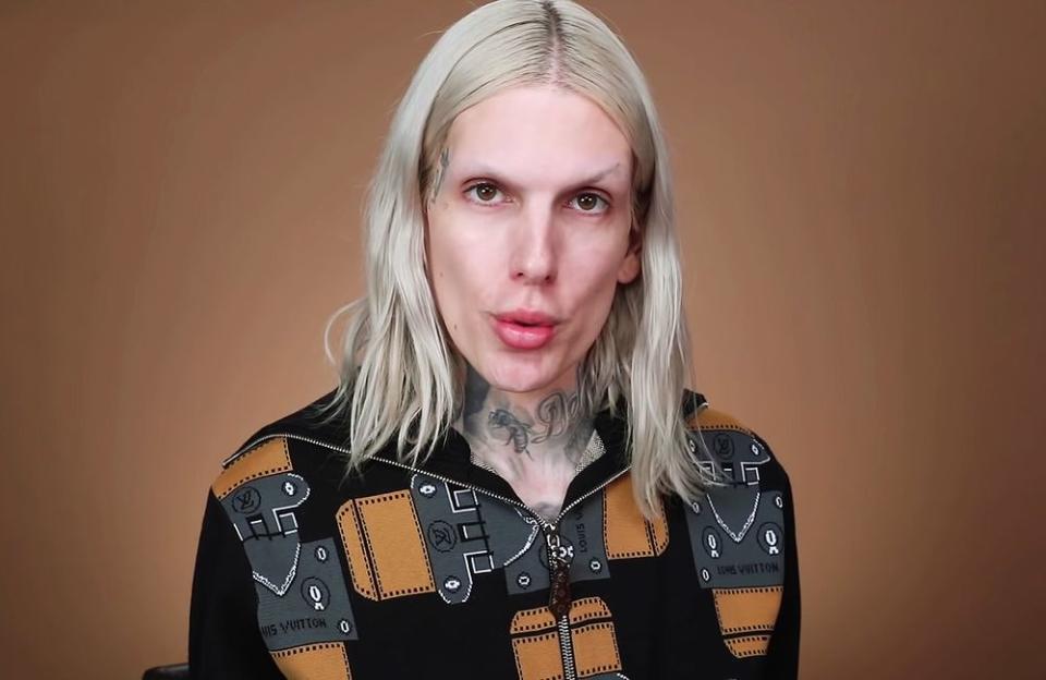 Jeffree Star Reveals a Doctor Secretly Injected His Lips With Silicone