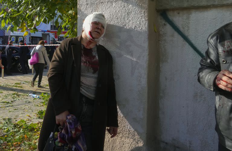 Una mujer herida por un bombardeo ruso, en Kiev, Ucrania, el lunes 10 de octubre de 2022. 
