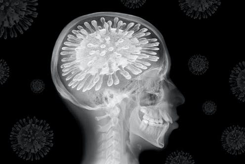 <span class="caption">The novel coronavirus is affecting our brains, whether we've caught it or not.</span> <span class="attribution"><a class="link " href="https://www.shutterstock.com/image-illustration/3d-illustration-xray-skull-covid19-instead-1662082387" rel="nofollow noopener" target="_blank" data-ylk="slk:Teo Tarras/Shutterstock;elm:context_link;itc:0;sec:content-canvas">Teo Tarras/Shutterstock</a></span>