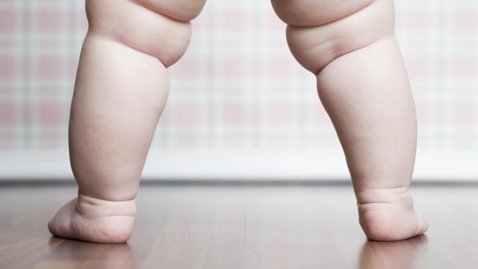 Piernas de bebé con sobrepeso.