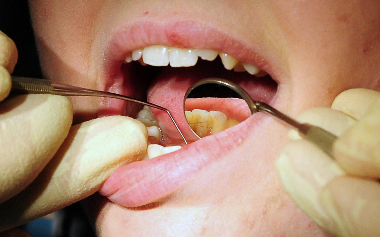 Many people are missing a regular check-up with an NHS dentist