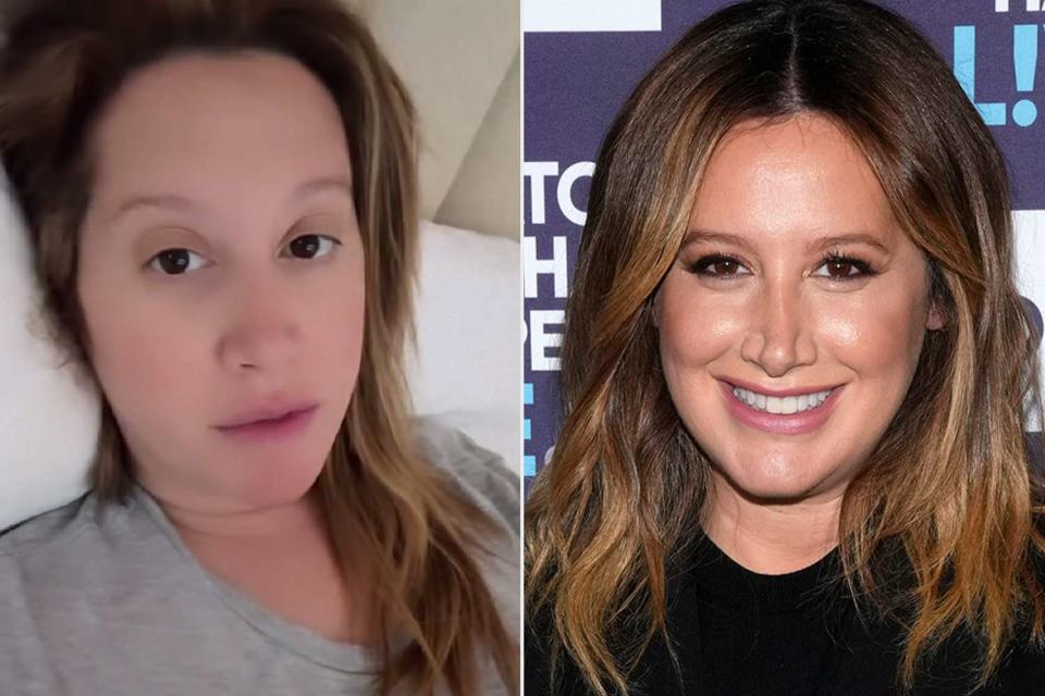 <p>Ashley Tisdale/Instagram; Charles Sykes/Bravo via Getty Images</p> Ashley Tisdale says being pregnant and sick is 