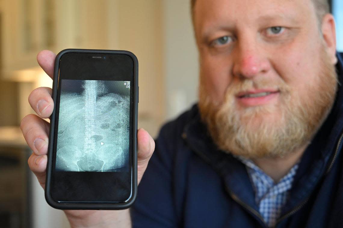 Jimmy Faseler keeps a CAT scan image showing the bullet that remains lodged in his belly.