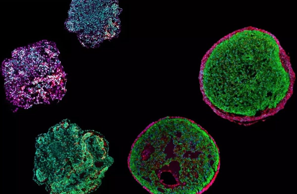 These “epicardioids” - organoids made from pluriopotent stem cells - are just 0.5 millimeters in size. Researchers can use them to mimic the development of the human heart in the laboratory and study hereditary heart diseases (Jam Press/Alessandra Moretti/TUM)