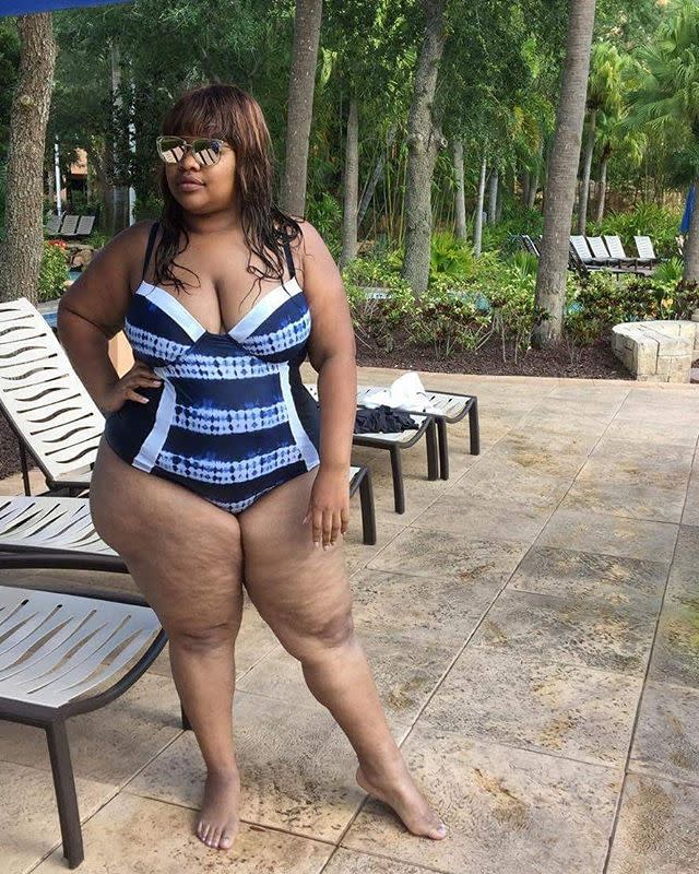 These Women Are Here to Remind You That Every Body Is a Bikini Body