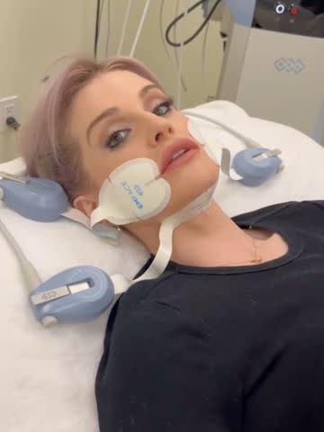 <p>Kelly Osbourne/Instagram</p> Kelly Osbourne posted herself getting EmFace treatments on Instagram.