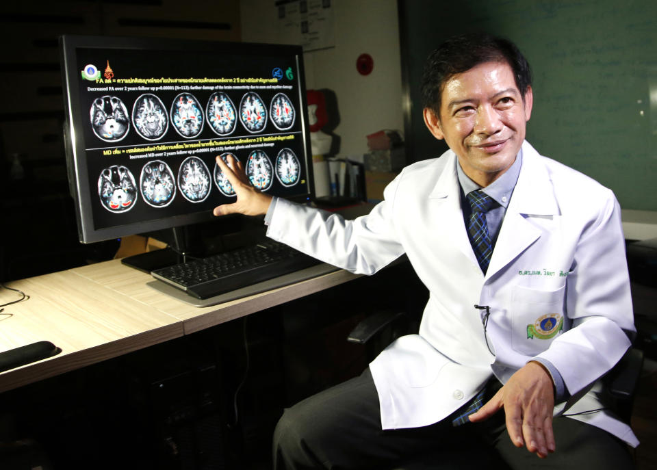 In this Wednesday, Nov. 14, 2018, photo, Dr. Witaya Sungkarat, Ramathibodi Hospital, explains brain scans from young boxers. Witaya said studies show that the sport caused damages, and in many cases, irreparable, in the young children's brain development. Thai lawmakers recently suggested barring children younger than 12 from competitive boxing, but boxing enthusiasts strongly oppose the change. (AP Photo/Sakchai Lalit)