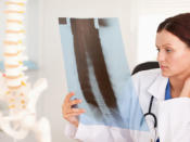 <b>Bone-Mineral Density Test</b> <p><b> Why you need it:</b>To find out whether you're at risk for osteoporosis. This crippling weakness of the bones afflicts nearly 10 million older Americans, 80 percent of whom are women, according to the National Osteoporosis Foundation. When and how often: Have your first DXA (dual-energy X-ray) test at age 65 and another every five years thereafter. Women can lose up to 30 percent of their bone mass in the five to seven years following menopause. Get tested at menopause if you weigh less than 127 pounds, have ever smoked, have a history of nontraumatic fractures as an adult, or have a family history of osteoporosis.</p> <p><b> What to expect:</b> The DXA test, the most accurate bone-density test, is safe and noninvasive: You lie fully clothed on a table while the X-ray machine scans your spine, hips, and wrists. If your bone density is low, your doctor may recommend the NTX test, a urine test that measures the rate at which you're losing bone mass; she may also want you to be X-rayed annually.</p> <p><b>What the results mean:</b> If your DXA shows you have osteopenia, a preosteoporotic state of low bone density, your doctor will recommend you consume at least 1,000 milligrams of calcium and 400 to 800 IUs of vitamin D daily without fail. (All women should get this amount, in fact.) She'll also suggest regular exercise. If you have osteoporosis, your doctor may give you a drug like Actonel or Fosamax.</p>