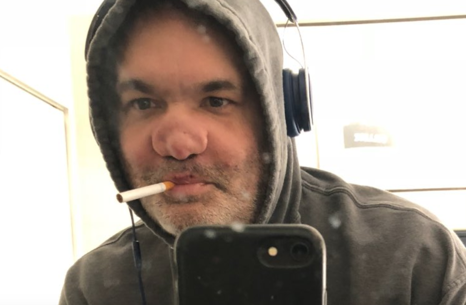 Artie Lange shares a photo of his damaged nose after “3 decades of drug abuse.” (Photo: Twitter)