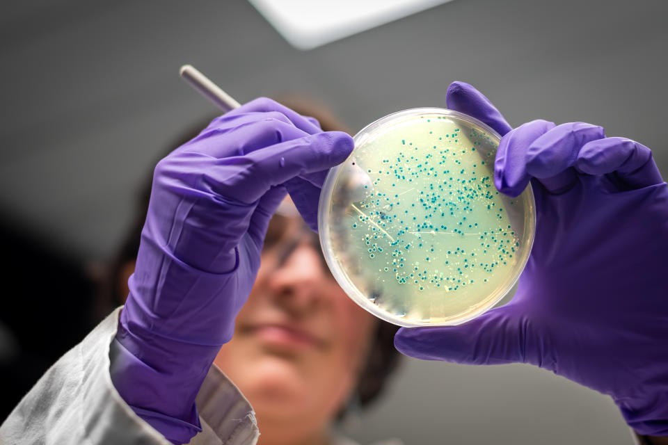 Badanie płytki z posiewem bakteryjnym przez badacza w laboratorium mikrobiologicznym.  W przeciwieństwie do wielu bakterii Listeria dobrze rośnie w warunkach chłodniczych.  (Getty)