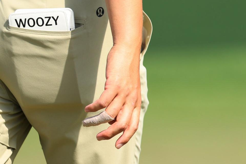 The injured finger of Min Woo Lee (Getty Images)