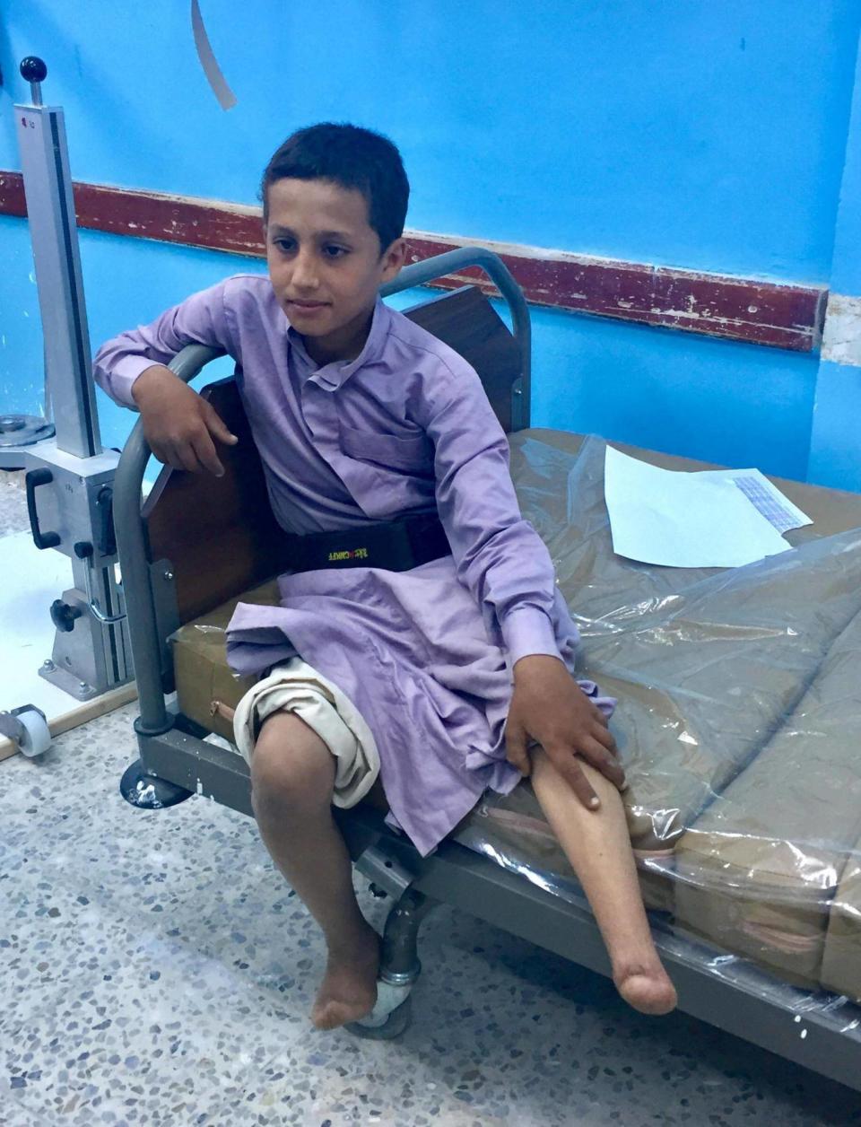 A boy who lost his left leg to a landmine is examined by a doctor at Marib General Hospital. Up to 16 people a week have been admitted needing amputations in recent months, hospital authorities said (Bethan McKernan)