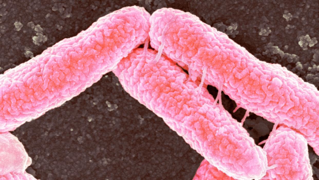  Microscope image of Escherichia coli bacteria in pink against a dark background. 