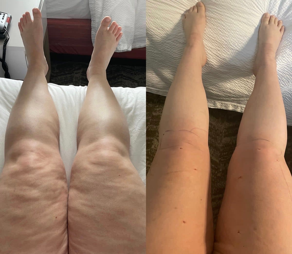 Before and after (Alisa Vandercruyssen / SWNS)