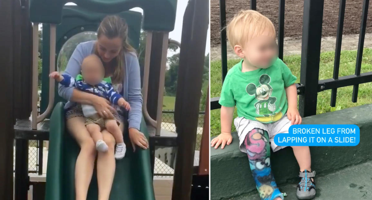 Frightening photo of toddler breaking her leg on slide is a