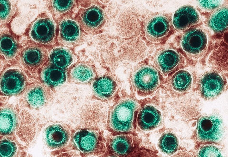 electron micrograph, herpes virus