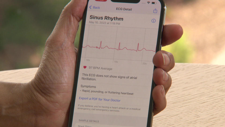Your personal devices can perform an electrocardiogram and export the results to your doctor.  / Credit: CBS News