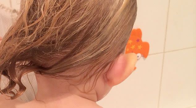 Kerry posted this image of her daughter Grace's swollen ear on Facebook, which helped to save the toddler's life. Photo: Facebook