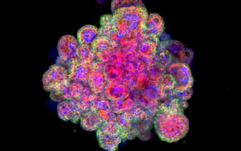 The mini-placenta shown under a microscope - Credit:   Margherita Turco, University of Cambridge