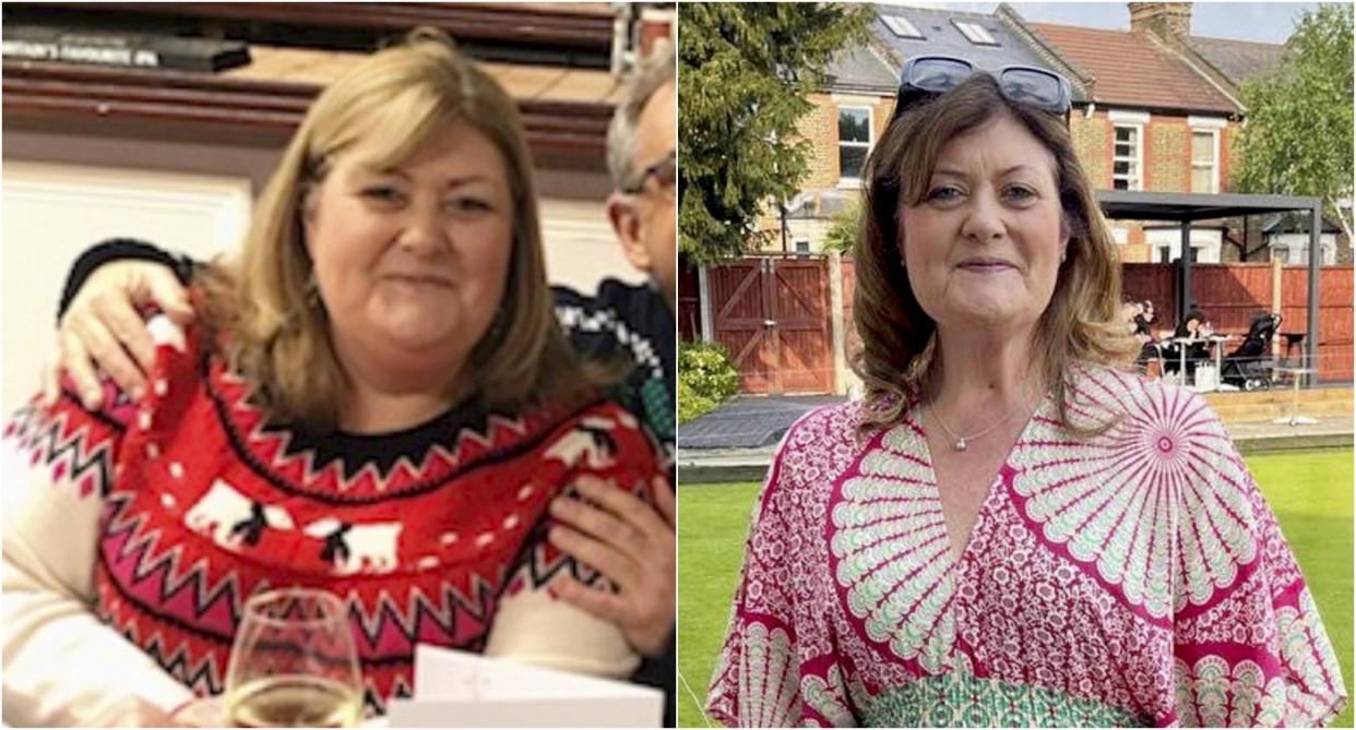 Jo Hurley saw a 10st weight loss after she suffered from septic shock. (SWNS)