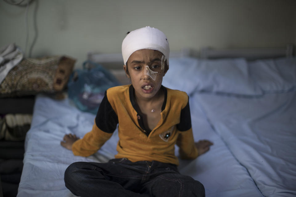 Nabaa, de diez años, se sienta en su cama en un hospital de Erbil, Irak, el sábado 8 de abril de 2017. (AP Foto/Felipe Dana)