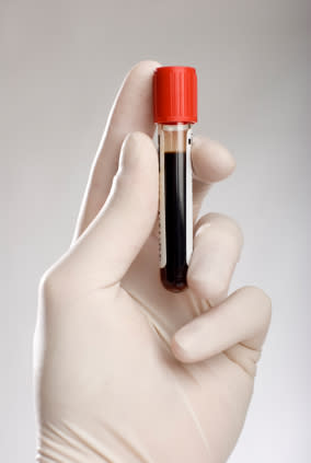 <div class="caption-credit"> Photo by: Babble</div><div class="caption-title">Lipid Profile</div>Starting at age 20, all women should have blood drawn for a comprehensive lipoprotein profile to measure the cholesterol in their body. According to the Cleveland Clinic, "cholesterol is needed by your body to maintain the health of your cells. [However], too much cholesterol leads to coronary artery disease." The results will determine how often blood needs to be drawn for more testing in the future. Cholesterol medication or dietary changes may be recommended based on the results.