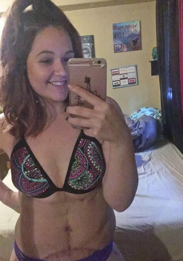 Kylie Merola has lost 79kgs and has celebrated by buying her first ever bikini! Source: Caters News