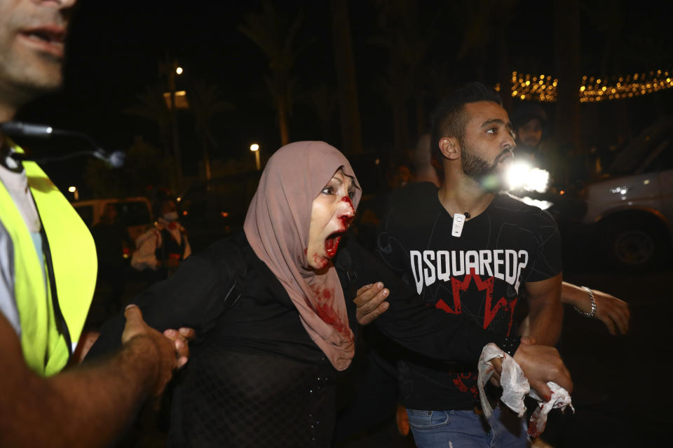 An injured Palestinian demonstrator is helped during a protest against the planned evictions of Palestinian families in the Sheikh Jarrah neighborhood of east Jerusalem, Saturday, May 8, 2021. (AP Photo/Oded Balilty)