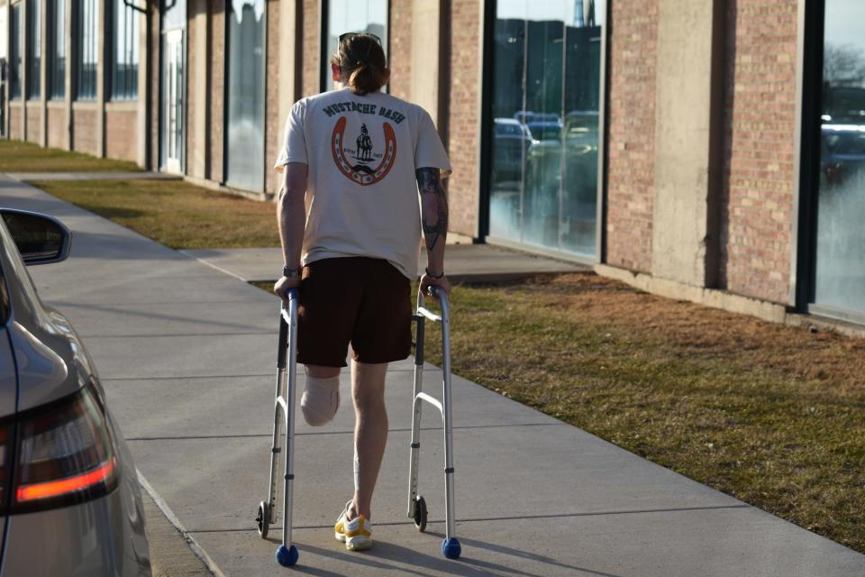 A welder by trade, Matt Reum's future is in doubt after his left leg was amputated above the knee. But he hopes to get a prosthetic leg and run a 5k race by Thanksgiving.