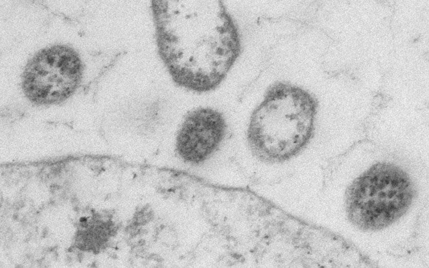 The modified lymphocytic choriomeningitis virus - Doron Merkler