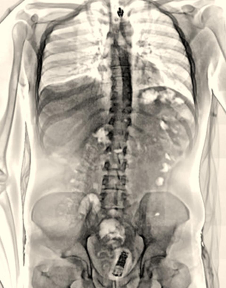 An X-ray body scan of a phone during an attempt to smuggle contraband behind bars (MoJ Handout/PA) (PA Media)