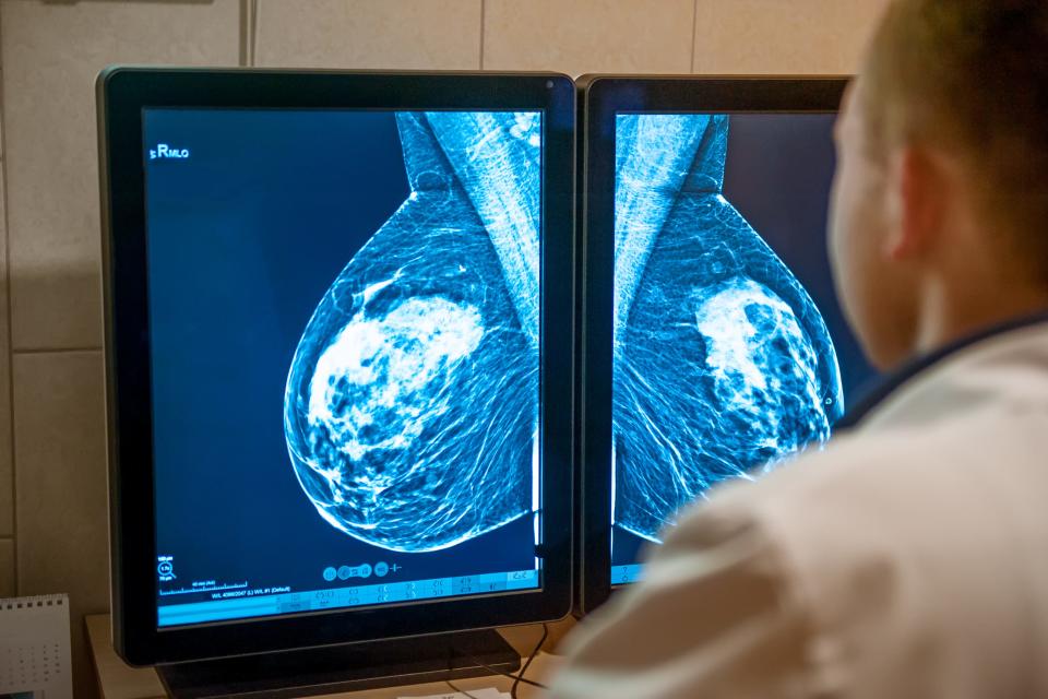A radiologist looking at a mammogram can only note the unusual changes that are visible. Clairity is hoping to catch changes before they would be seen.