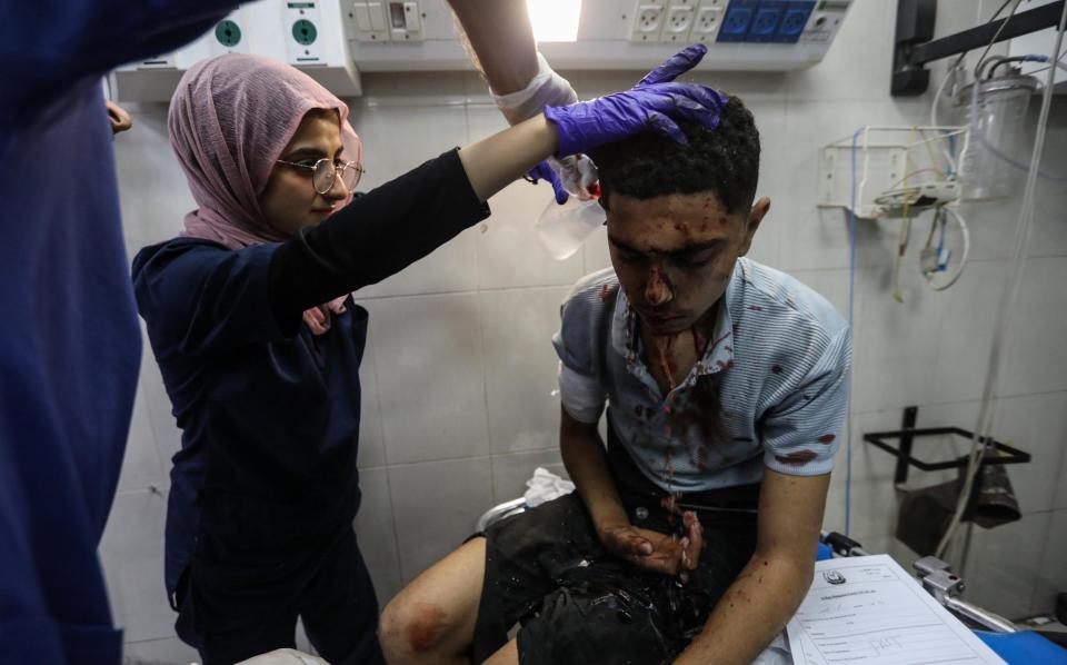 A Palestinian injured in Israeli airstrikes is treated at Nasser Medical Hospital