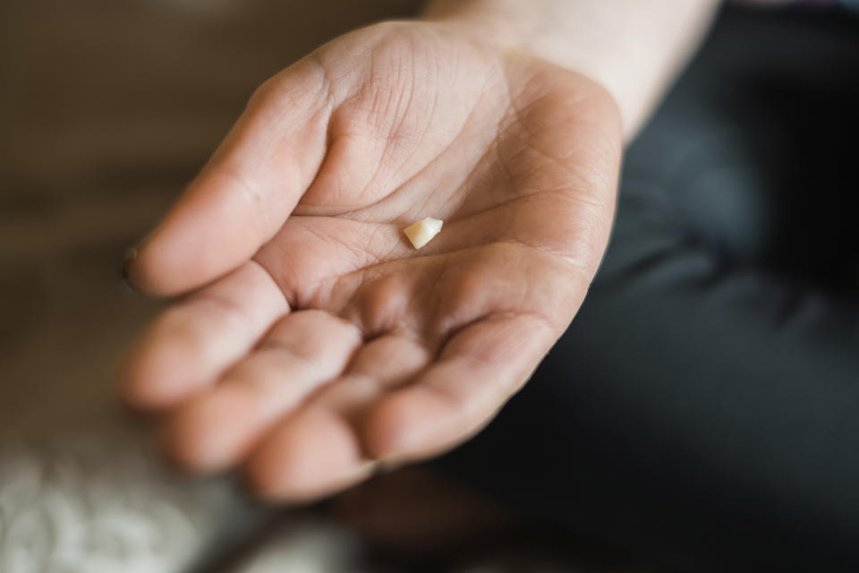 A child holds out a baby tooth in their hand. 