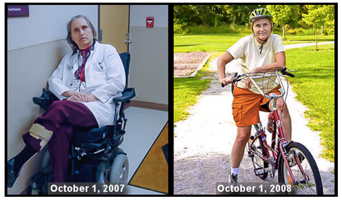 <span class="caption">Terry Wahls before and after she changed her diet.</span> <span class="attribution"><span class="license">Author provided</span></span>