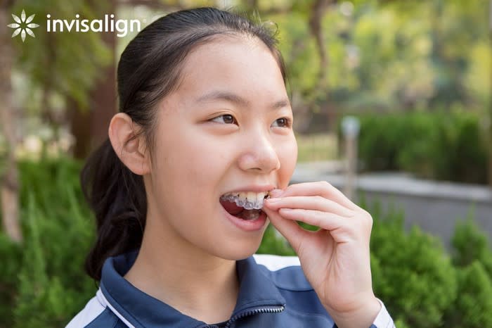 Young person removing Invisalign orthodonic device.
